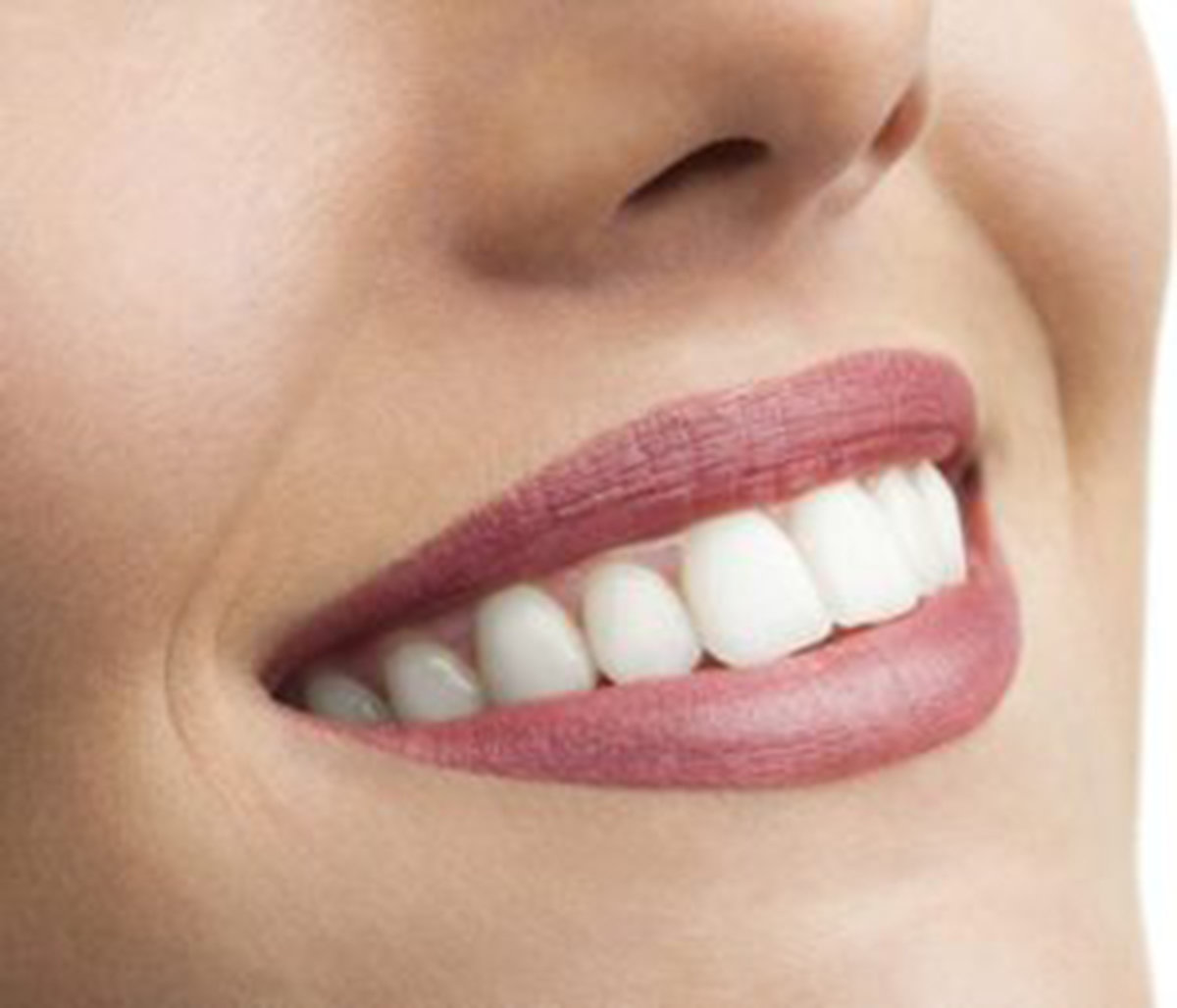 Achieving your best smile with the help of a cosmetic dentist in Raleigh, NC
