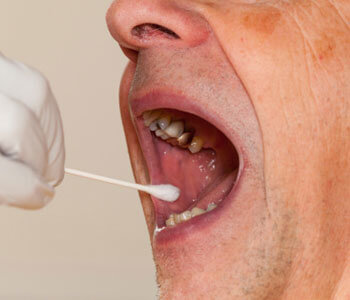 Advantages Of Mercury Safe Dentistry