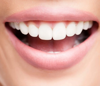Charlotte area dentist discusses dental bonding for repairing teeth