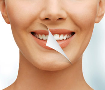 Charlotte, NC area patients ask, do dental crowns respond to teeth whitening?
