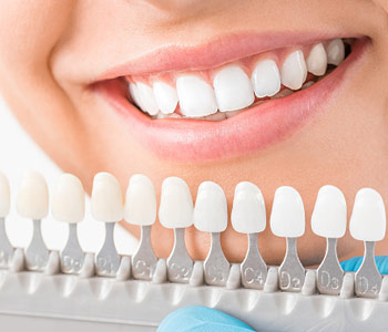 Cornelius area dentist reviews the benefits of teeth whitening