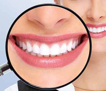 how tooth bleaching can provide the best results for teeth whitening