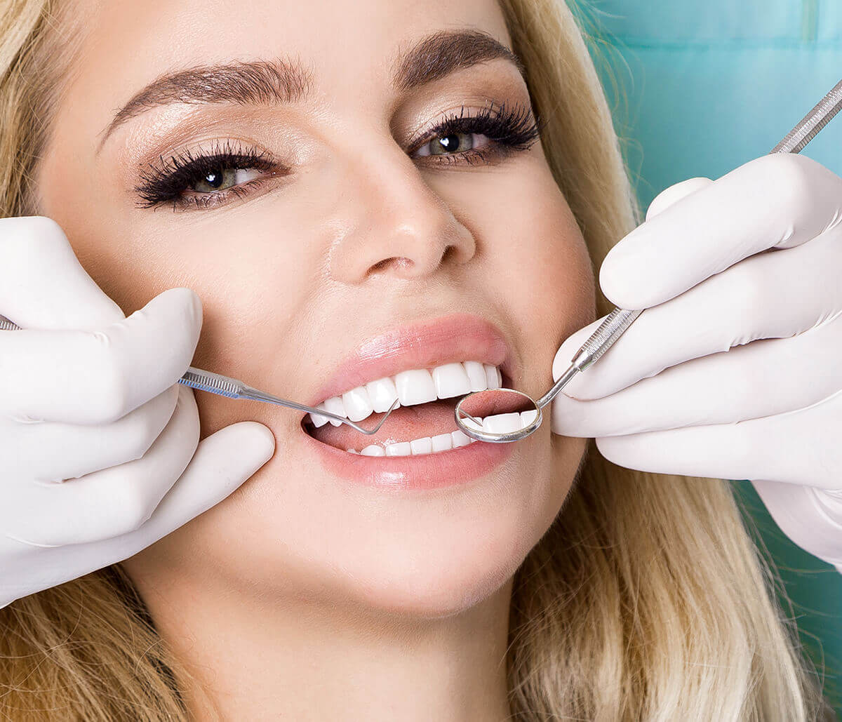 Dental Veneers at Holistic Dental Centers in Cary NC Area
