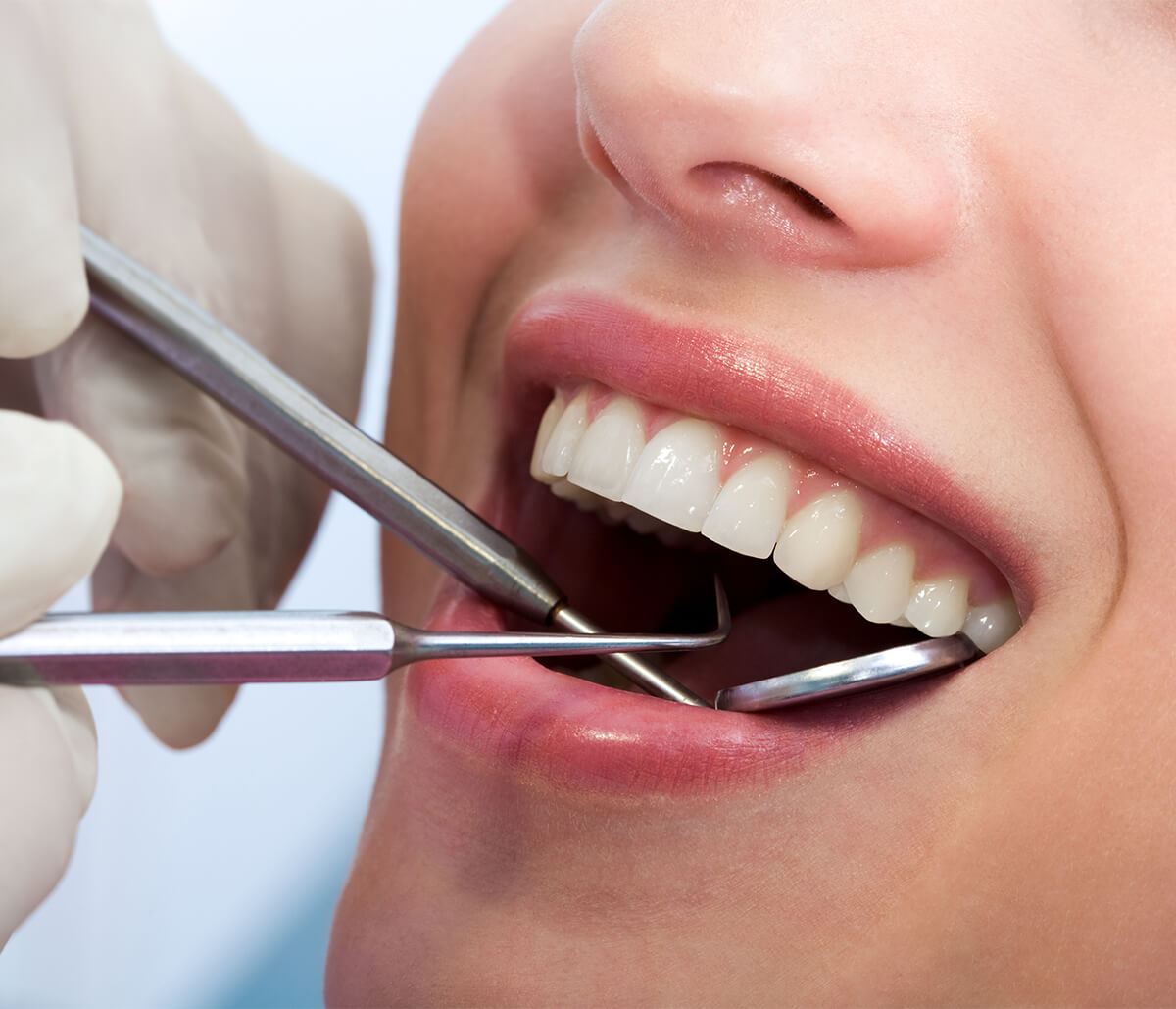 How to Find a Holistic Dentist in Cary NC Area